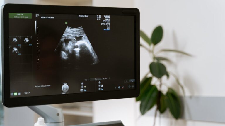 Échographie de grossesse sur l'écran en clinique